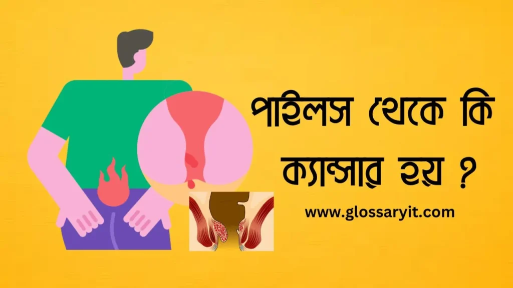 পাইলস এর ঘরোয়া চিকিৎসা